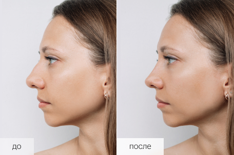 До / После