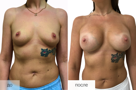 До / После